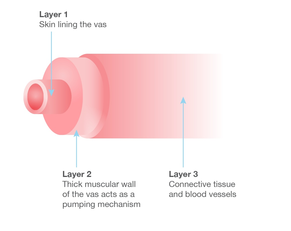 Multi-layer Microdot Vasovasostomy Step 1
